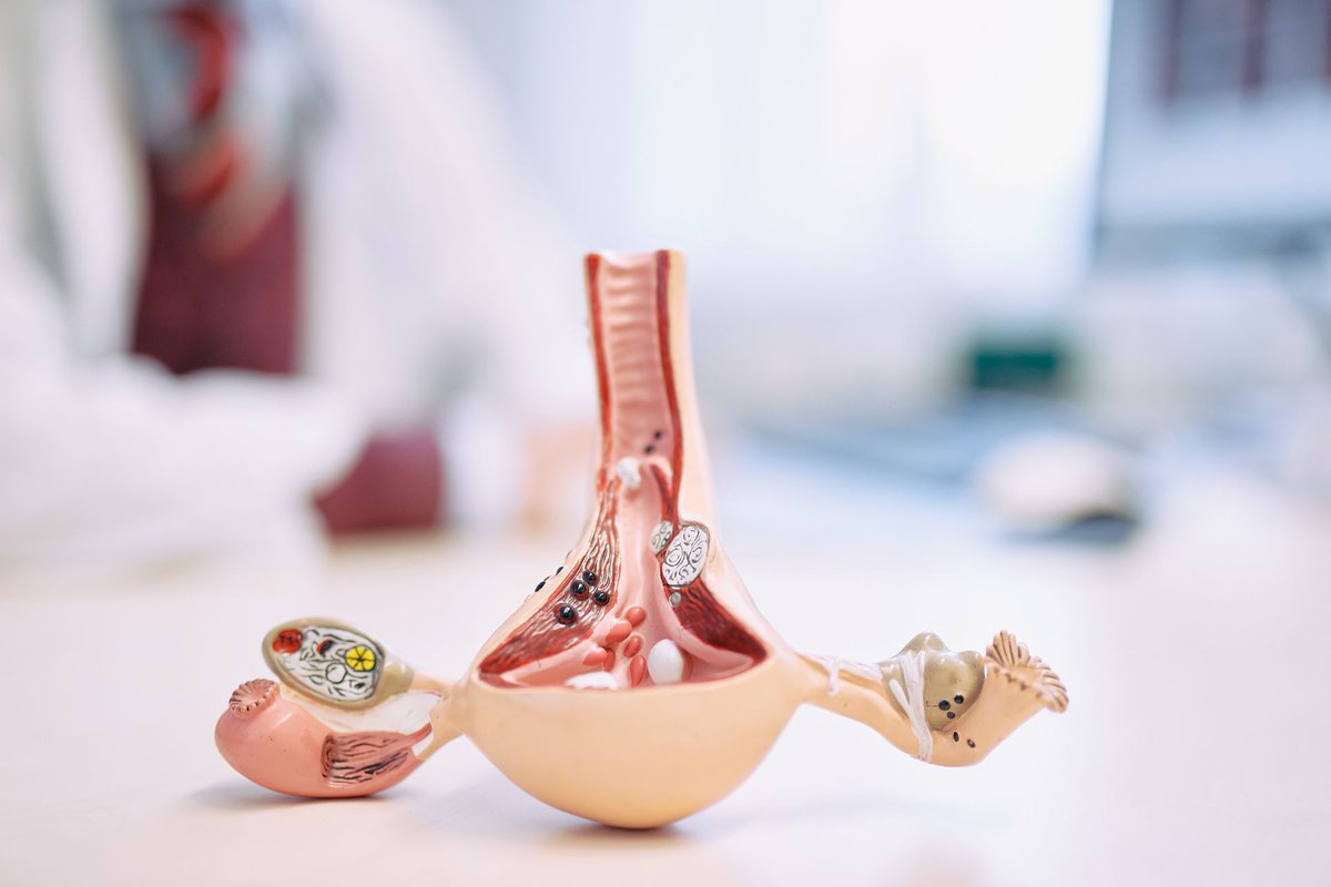 NMI (@nmi_de) on Twitter photo #Endometriose-Forschung: #NMI an Projekt ENDO-RELIEF des <a href="/uktuebingen/">Uniklinikum Tübingen</a> beteiligt. Forscherin Julia Marzi will Entwicklung der Krankheit in den Zellen beobachtbar machen und damit zur Entwicklung von Therapien beitragen.
nmi.de/projekte-1/pro…
Bild: Beate Armbruster, UKT #Endometriose-Forschung: #NMI an Projekt ENDO-RELIEF des <a href="/uktuebingen/">Uniklinikum Tübingen</a> beteiligt. Forscherin Julia Marzi will Entwicklung der Krankheit in den Zellen beobachtbar machen und damit zur Entwicklung von Therapien beitragen.
nmi.de/projekte-1/pro…
Bild: Beate Armbruster, UKT