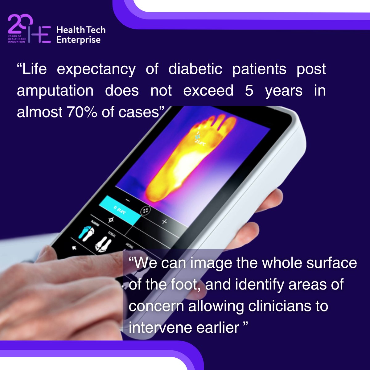 In the second of our interviews to celebrate our 20th anniversary this year we're putting the spotlight on <a href="/Thermo_Health/">Thermology Health</a> who are transforming diagnostic healthcare through the use of thermal imaging. Read the interview with CEO Yuval Yashiv below. 

bit.ly/3XeOJyv <a href="/NPL/">NPL</a>
