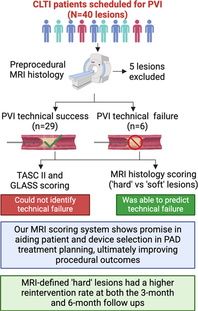 Check out our latest JVS article showing the utility of MRI scoring for improving endovascular patient selection for PVI. Lesion composition matters! clinicalkey.com/#!/content/pla…