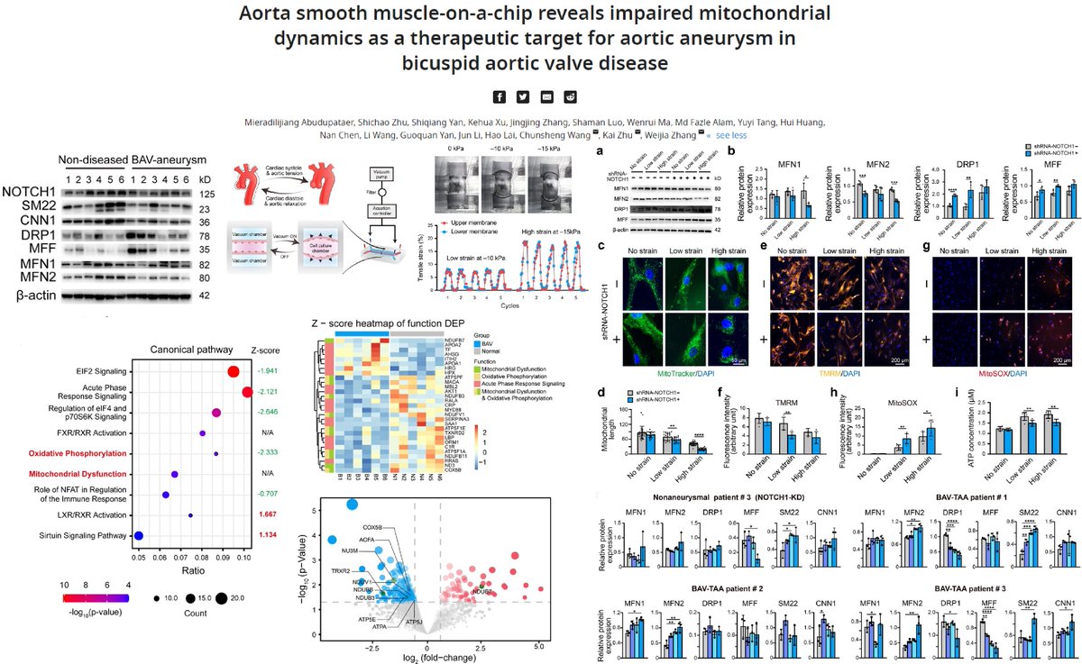 HaoYin20's tweet image. #AortaOnAChip  

Aortic #SmoothMuscleCell grown in a 3-layered PDMS #Microfluidics +#CyclicStrech reveal Notch1 deficiency-induced #MitochondrialDysfunction in #BicuspidAorticValve #AorticAneurysm

Vacuum-induced rhythmic strain😎

@eLife 2021
elifesciences.org/articles/69310