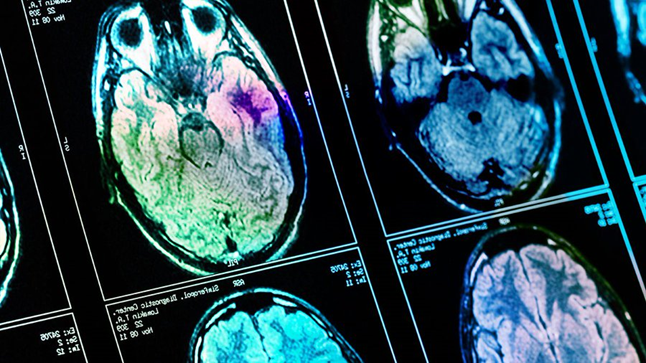 Brain donation has helped researchers to better understand diseases such as #Schizophrenia , #Alzheimers and #Parkinsons.

A list of human tissue banks which accept brain donations is available on our website: 

hta.gov.uk/guidance-publi…