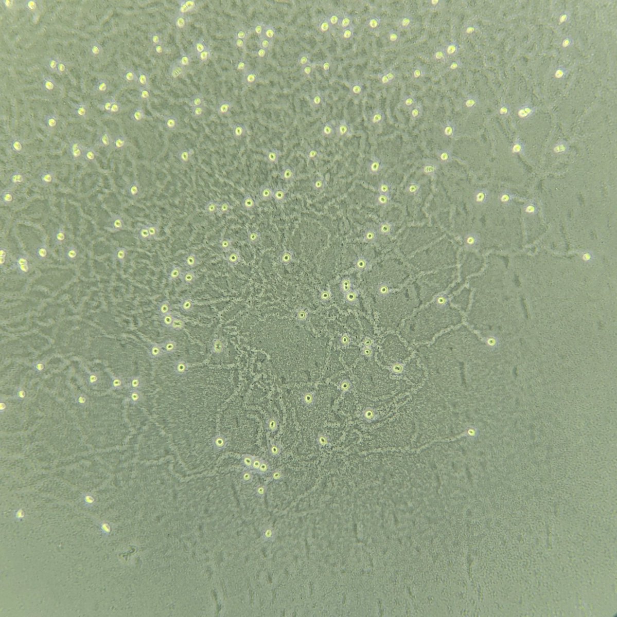 Sarahmoeba's tweet image. Happy Friday! I hope you get a chance to go on a little adventure this weekend, like these exploring amoebae carving trails in their bacteria lawn.