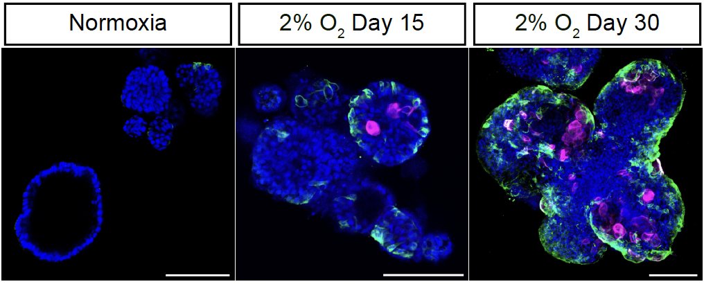 Delighted to share the lab's latest preprint from <a href="/DongZiqi94150/">ZIQI DONG</a> <a href="/GurdonInstitute/">Gurdon Institute</a> showing an unexpected role for hypoxia in human lung differentiation: doi.org/10.1101/2024.0… 
Fabulous job working out the mechanisms Ziqi!
Many thanks to our brilliant collaborators 😀