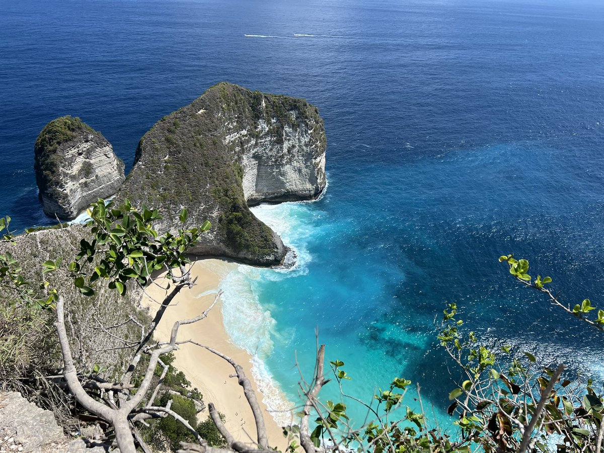 Kazumi Taguchi (@kazumi_taguchi) on Twitter photo Best memories of my short <a href="/uaa2024bali/">uaa2024bali</a> trip! Lots of new devices and innovations, but now it’s time to move on to more eco-friendly practice!
@ShenZhenHugeMed #WorkLifeBalance #MedTwitter #bioplastics Best memories of my short <a href="/uaa2024bali/">uaa2024bali</a> trip! Lots of new devices and innovations, but now it’s time to move on to more eco-friendly practice!
@ShenZhenHugeMed #WorkLifeBalance #MedTwitter #bioplastics