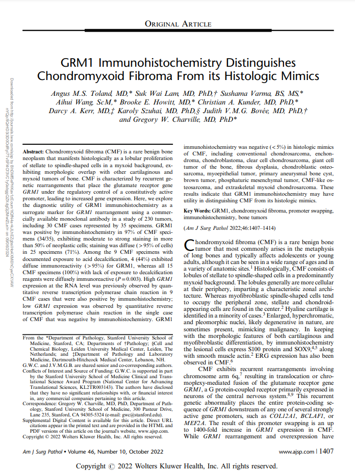 Andrew Bellizzi 🇺🇦 (@ihc_guy) on Twitter photo I am beyond over the moon to announce our kickoff ISIMM webinar for the academic year, this Wednesday, September 11 at 11 am ET.
<a href="/StanfordPath/">Stanford Pathology</a>'s <a href="/Greg_Charville/">Greg Charville</a> will present on Bone Tumor IHC.
Register here: us02web.zoom.us/webinar/regist…
Share widely! I am beyond over the moon to announce our kickoff ISIMM webinar for the academic year, this Wednesday, September 11 at 11 am ET.
<a href="/StanfordPath/">Stanford Pathology</a>'s <a href="/Greg_Charville/">Greg Charville</a> will present on Bone Tumor IHC.
Register here: us02web.zoom.us/webinar/regist…
Share widely!