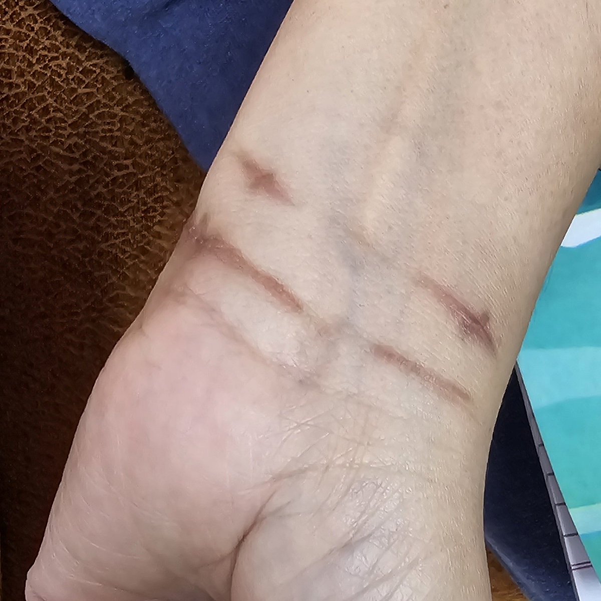 ColAmitkumar's tweet photo. Is this the way to treat a patient who has given 20 years? Inquiry by those who are themselves  accused and a Complaint can be seen. Inhuman it was? @adgpi @BJP4India @INCIndia @AamAadmiParty @DGPHaryana https://t.co/2NCsWCHLCo