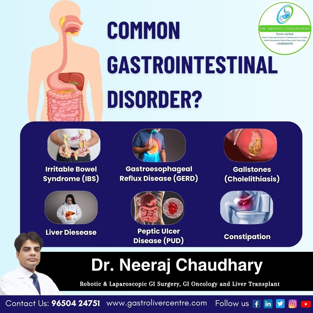 gastroandliverc's tweet image. 𝐂𝐨𝐦𝐦𝐨𝐧 𝐆𝐚𝐬𝐭𝐫𝐨𝐢𝐧𝐭𝐞𝐬𝐭𝐢𝐧𝐚𝐥 𝐃𝐢𝐬𝐨𝐫𝐝𝐞𝐫

Get rid to all Gastrointestinal Disorder with the personalized treatment, Get in touch with Dr. Neeraj Chaudhary, Best GI Surgeon in Greater Noida.
-
#GastroandLiverCentre #DrNeerajChaudhary #GastrointestinalDisorder