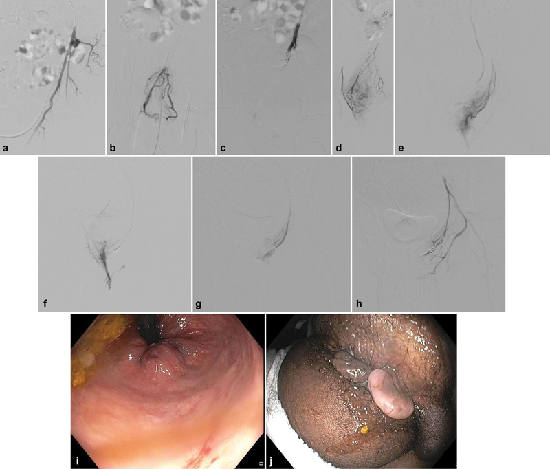 Seminars in Interventional Radiology tweet media