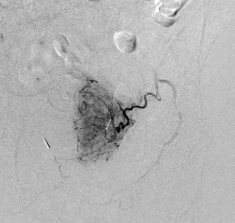 Seminars in Interventional Radiology tweet media
