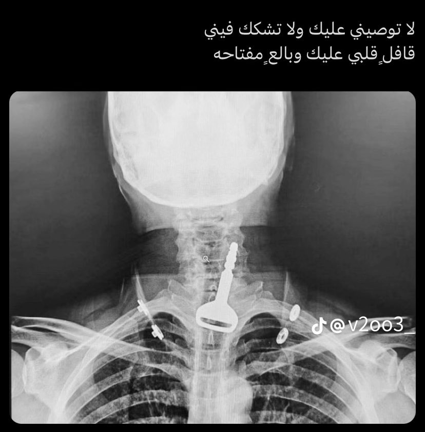 عتيبي tweet media