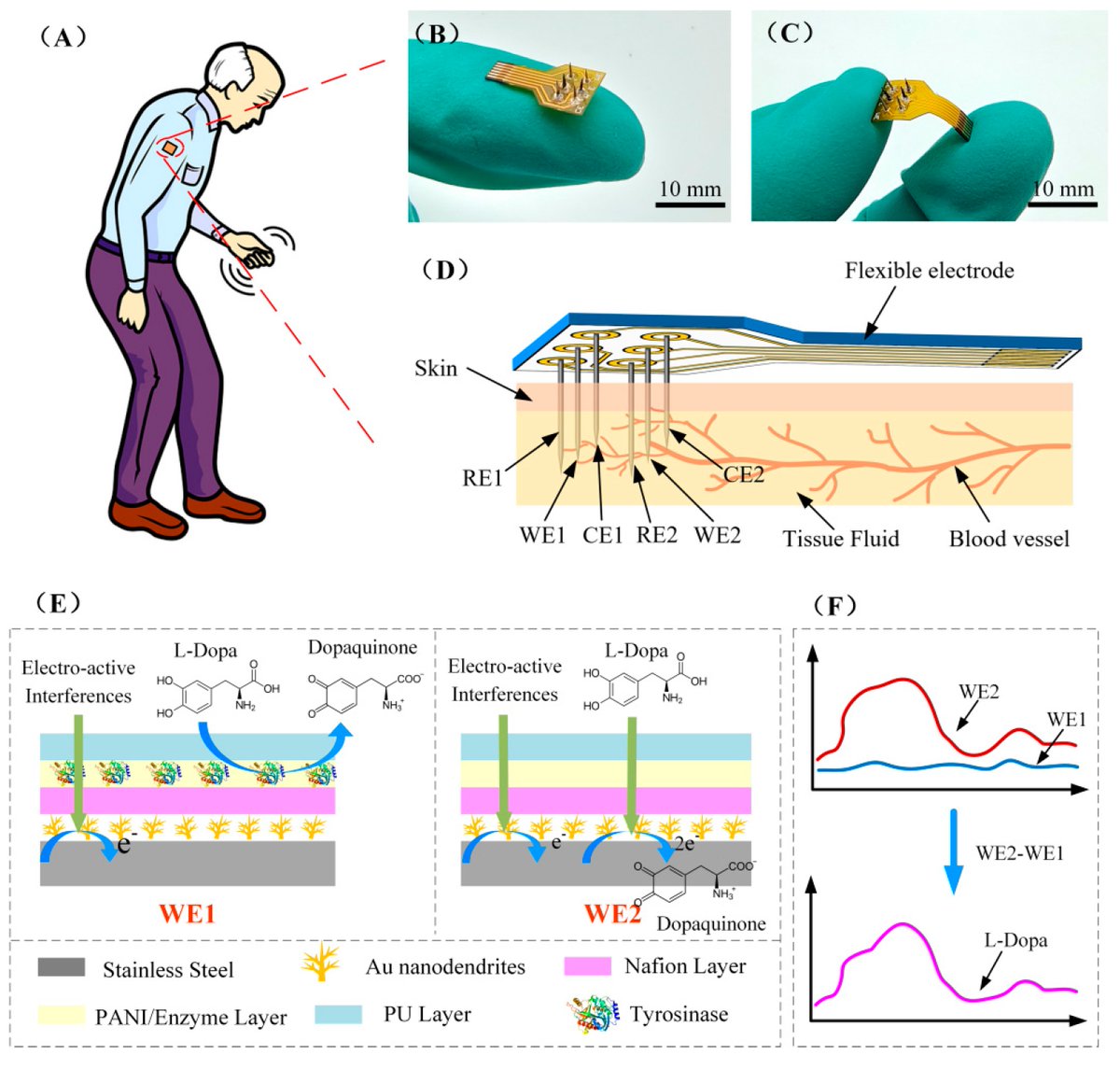Biosensors_MDPI's tweet image. #Article
Differential Amperometric Microneedle Biosensor for Wearable Levodopa Monitoring of Parkinson’s Disease
by Lihua Li, Xuesong Ye and Bo Liang
mdpi.com/2079-6374/12/2…
@MDPIOpenAccess
@ChemMatSci_MDPI
 
#Microneedle #Parkinson #Wearable #biosensors