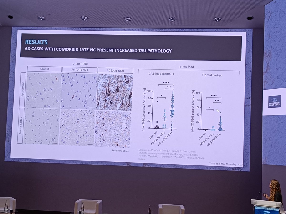 gesalbla's tweet photo. Starting with an enlightening presentation from @sandraneuropath about tau pathology being exacerbated by the presence of TDP-43. https://t.co/UQU18lFOXA