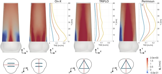 CVE_ARTORG's tweet photo. Quantitative comparison of the novel TRIFLO heart valve to state-of-the-art heart valve prostheses using tomographic PIV: differences in TVPG, EOA, turbulence levels and flow patterns.
see: https://t.co/WROEj1Vm1z https://t.co/lZ5TGoY3cH