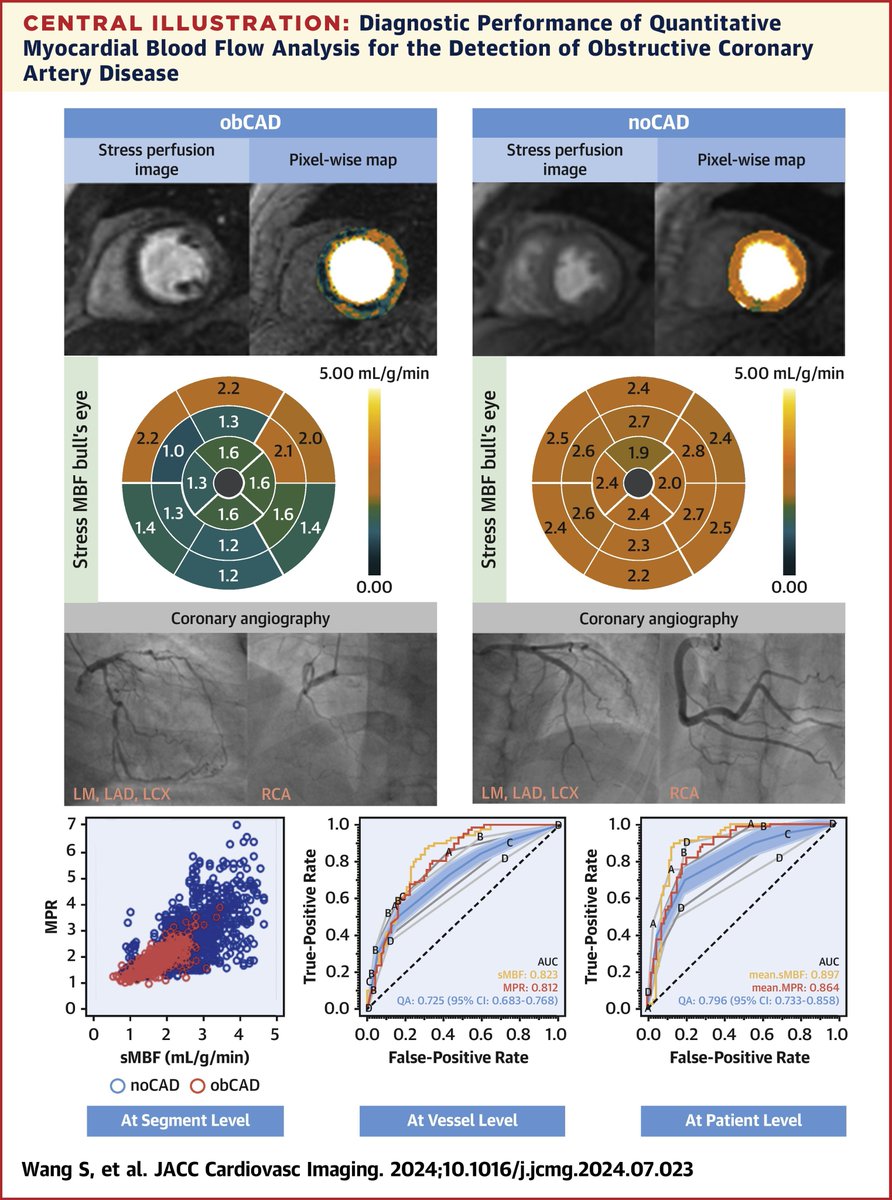 Ibrahim M Saeed MD FACC (@ibrahimmsaeed1) on Twitter photo 1/4 Myocardial blood flow quantification using Stress Perfusion #WhyCMR is an AMAZING. It has the potential to allow ANYONE to be an expert reader <a href="/SCMRorg/">Society for Cardiovascular Magnetic Resonance</a>. AUCs of 0.90 for global sMBF & 0.86 for MPR! Check out sciencedirect.com/science/articl⦠1/4 Myocardial blood flow quantification using Stress Perfusion #WhyCMR is an AMAZING. It has the potential to allow ANYONE to be an expert reader <a href="/SCMRorg/">Society for Cardiovascular Magnetic Resonance</a>. AUCs of 0.90 for global sMBF & 0.86 for MPR! Check out sciencedirect.com/science/articlā¦