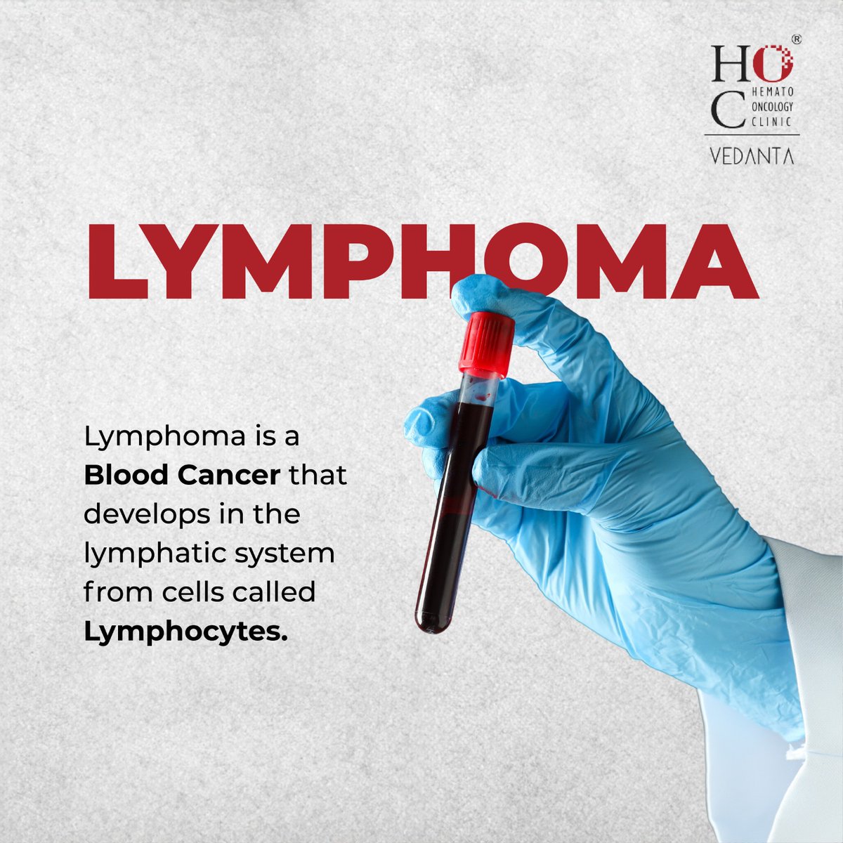 HocVedanta's tweet photo. Non-Hodgkin lymphoma can develop in lymph nodes throughout the body, while Hodgkin lymphoma usually starts in areas like the neck, chest, or armpits. Hodgkin lymphoma progresses more predictably, making it easier to detect and treat. #BloodCancerAwarenessMonth
#hocvedanta #hoc https://t.co/zUbYdABMCb