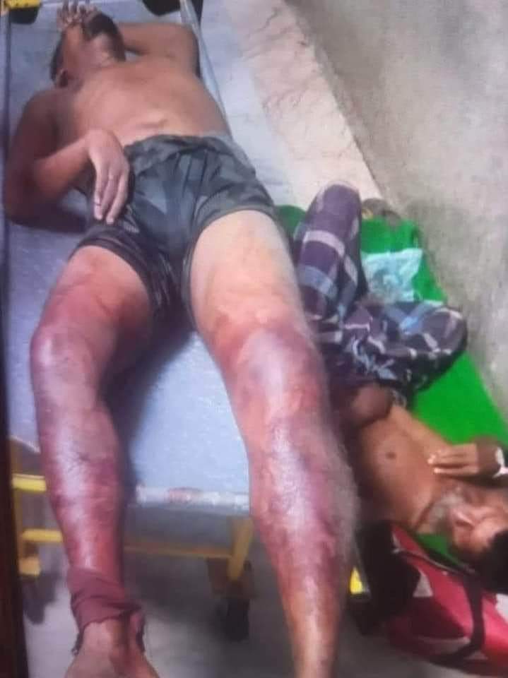 নির্মমতা কতদূর হলে জাতি হবে নির্লজ্জ!
