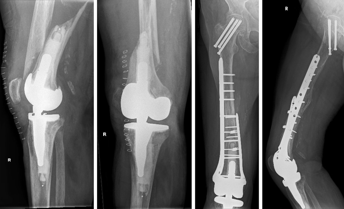 Arthroplasty Today tweet media