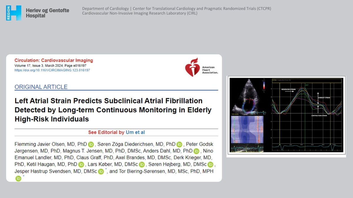 CTCPR Trials & CIRL (@ctcpr_) on Twitter photo 🫀 LA strain predicts subclinical atrial fibrillation (SCAF) in elderly at risk of stroke. Low reservoir strain (<33%) = higher SCAF risk. Even applies to those with normal LA size & diastolic function. 📊🩺 #AFib #Cardiology #Echocardiography #LOOPStudy
ahajournals.org/doi/10.1161/CI… 🫀 LA strain predicts subclinical atrial fibrillation (SCAF) in elderly at risk of stroke. Low reservoir strain (<33%) = higher SCAF risk. Even applies to those with normal LA size & diastolic function. 📊🩺 #AFib #Cardiology #Echocardiography #LOOPStudy
ahajournals.org/doi/10.1161/CI…