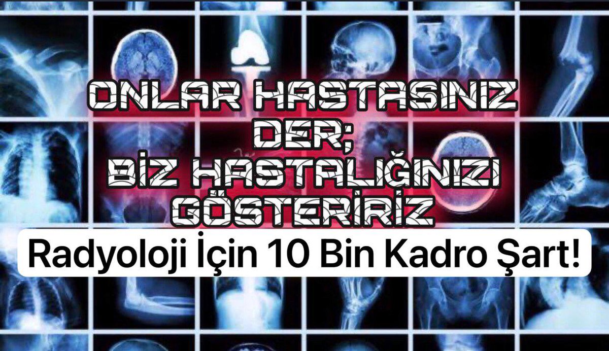 Sadece bizler mağdur değiliz,  vatandaşlarımız daha mağdur

<a href="/drmemisoglu/">Prof. Dr. Kemal Memişoğlu</a> 
<a href="/saglikbakanligi/">T.C. Sağlık Bakanlığı</a> 
#Radyolojiye10BinAtama