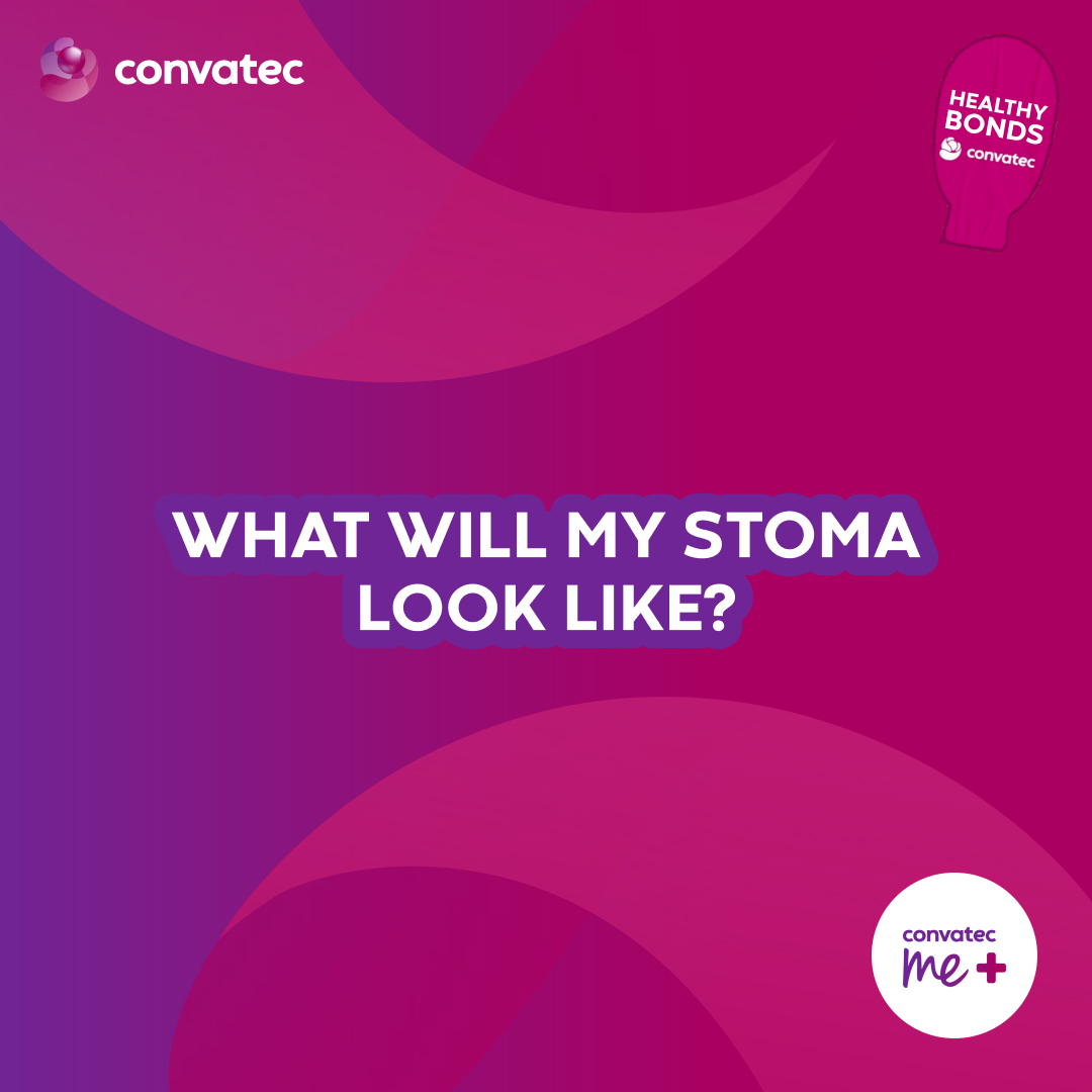ostomysecrets's tweet photo. Our me+™ specialist advisors are here to help with your urostomy questions.

Whether you're pre or post-surgery, getting your questions answered can really help in making you feel better, sooner.

So, whatever your questions, you can contract our me+ team at 1-800-422-8811. https://t.co/kxqaxxg93v