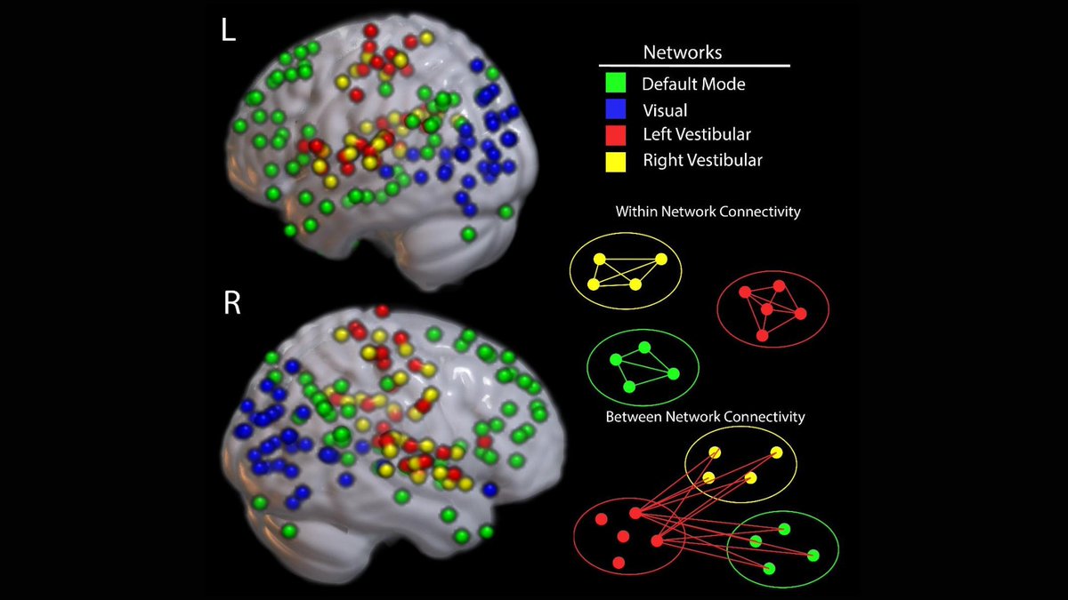 How does microgravity impact the brain's neuroplasticity in space? 

<a href="/UF_HHP/">UF College of Health & Human Performance</a> Professor of Applied Physiology &amp; Kinesiology @SeidlerRachael explores the brain's adaptability in different environments, helping experts develop low-gravity countermeasures for astronauts.