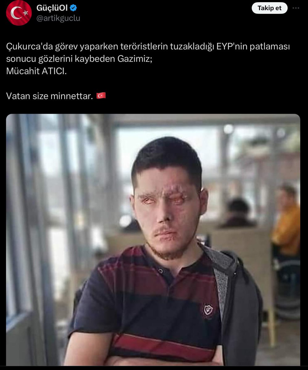 Can CEM 🇹🇷 tweet media