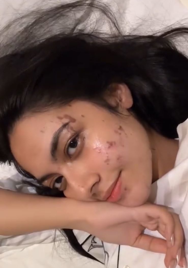 batmanstweety's tweet photo. yahi umeed thi colors se! I hope ab issko leke bakwaas na karein log. 
She had an accident, she is recovering, she will be better! Ameen. 
#LaughterChefs https://t.co/XL5opo8Et4
