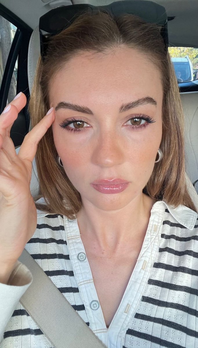 burcuozberkbr's tweet image. 📸| 🤍
@/burcuozberk • IG Story
#BurcuÖzberk