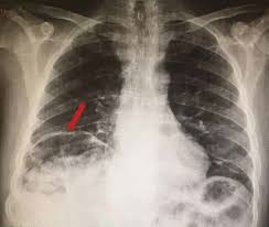 Federico Mayorgas tweet media