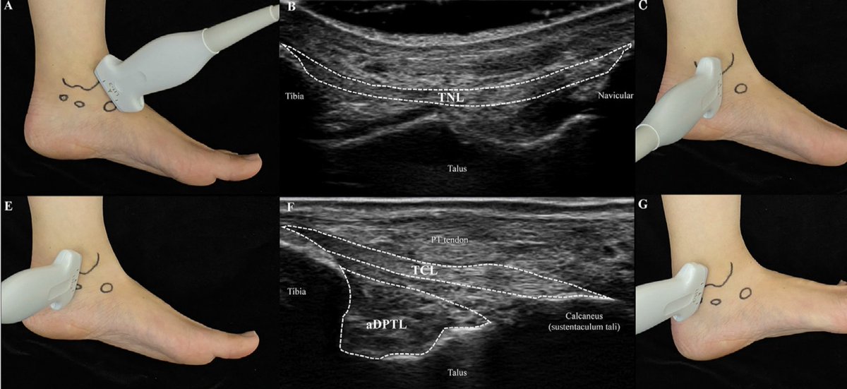 Sᴡɪss Uʟᴛʀᴀsᴏᴜɴᴅ Cᴇɴᴛᴇʀ - UZR tweet media