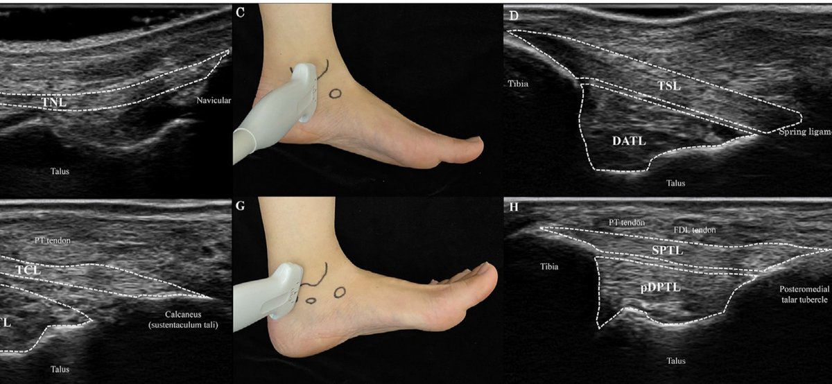 Sᴡɪss Uʟᴛʀᴀsᴏᴜɴᴅ Cᴇɴᴛᴇʀ - UZR tweet media