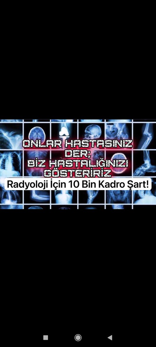 MEHMET18556790's tweet photo. #Radyolojiye10BinAtama https://t.co/mU9mtDcgfI
