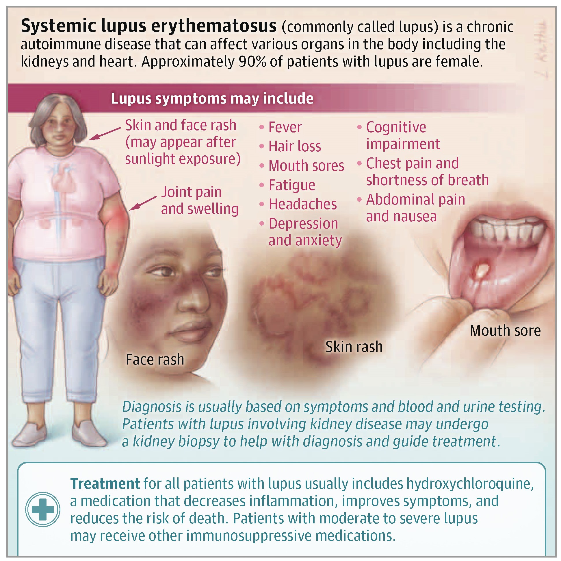 lupus-symptoms-lupus-and-your-skin-signs-and-symptoms