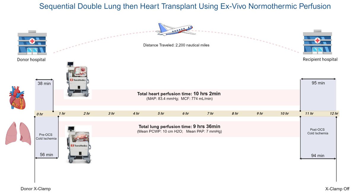 Hosam F. Ahmed (@hosam_f_ahmed) on Twitter photo Another First: Heart-Lung transplant w/ two separate ex-vivo machines with >10hrs perfusion time, >2,200 miles distance. Congrats to the team at <a href="/CincyKidsHeart/">Cincinnati Children's Heart Institute</a> <a href="/CincyChildrens/">Cincinnati Children's</a> #transplant #hearttransplant #lungtransplant #exvivoperfusion <a href="/TheJHLT/">JHLT</a>
jhltonline.org/article/S1053-… Another First: Heart-Lung transplant w/ two separate ex-vivo machines with >10hrs perfusion time, >2,200 miles distance. Congrats to the team at <a href="/CincyKidsHeart/">Cincinnati Children's Heart Institute</a> <a href="/CincyChildrens/">Cincinnati Children's</a> #transplant #hearttransplant #lungtransplant #exvivoperfusion <a href="/TheJHLT/">JHLT</a>
jhltonline.org/article/S1053-…