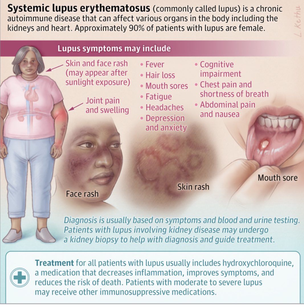 What Is Lupus(Systemic Lupus Erythematosus SLE)?