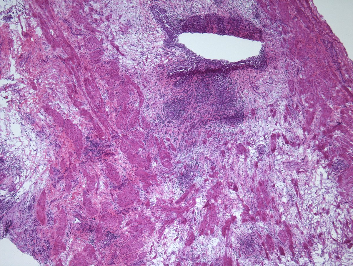 Miruna Popescu, MD tweet media