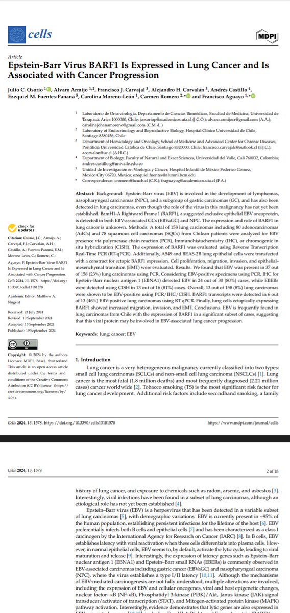 Juliogen's tweet image. Epstein-Barr Virus BARF1 is expressed in lung cancer and is associated with cancer progressionhttps://www.researchgate.net/publication/384011800_Epstein-Barr_Virus_BARF1_is_expressed_in_lung_cancer_and_is_associated_with_cancer_progression