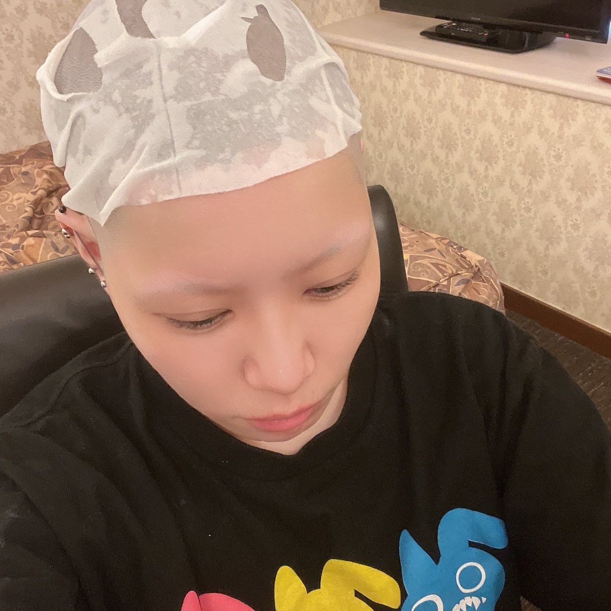 ハゲ保湿中