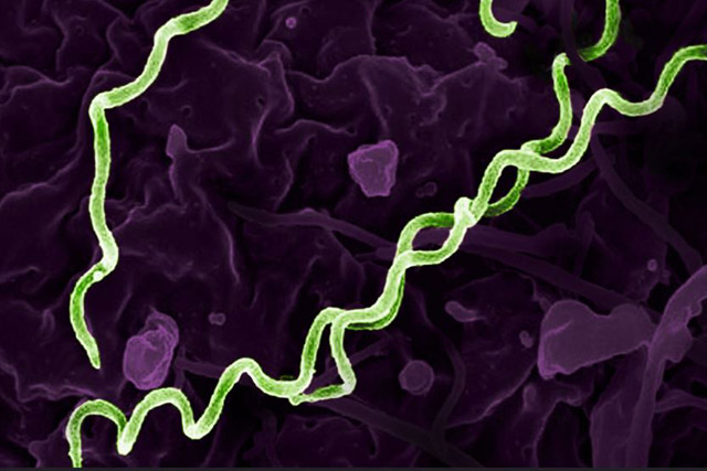 UW Medicine Newsroom (@uwmnewsroom) on Twitter photo As U.S. syphilis cases surge, <a href="/uwlabmedpath/">UW Dept. of Laboratory Medicine and Pathology 🔬</a> researchers are determined to improve diagnostic tests for the infection. Untreated cases can cause severe harm. Grants <a href="/NIAIDNews/">NIAID News</a> <a href="/NIH/">NIH</a> awarded to <a href="/GreningerLab/">Greninger Lab</a> <a href="/MolMicro_Path/">Josh Lieberman, MD, PhD</a> & Salipante lab tinyurl.com/tsa6xh4m As U.S. syphilis cases surge, <a href="/uwlabmedpath/">UW Dept. of Laboratory Medicine and Pathology 🔬</a> researchers are determined to improve diagnostic tests for the infection. Untreated cases can cause severe harm. Grants <a href="/NIAIDNews/">NIAID News</a> <a href="/NIH/">NIH</a> awarded to <a href="/GreningerLab/">Greninger Lab</a> <a href="/MolMicro_Path/">Josh Lieberman, MD, PhD</a> & Salipante lab tinyurl.com/tsa6xh4m