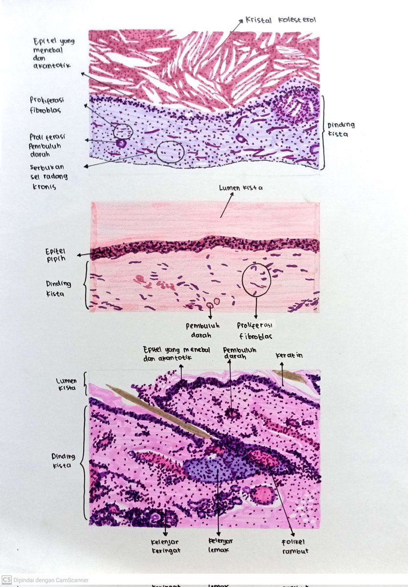 jokigambar_toji's tweet photo. Halo guys yg mau jasa gambar preparat histologi epitel joki gambar preparat histologi epitel buat tugas kuliah kampus Grogol Jakarta barat kertas/buku boleh dari cust bisa dikirim hasil fisik 🥰

#zonauang #jokitugas #jasagambar #jokigambar #histologi #preparat #epitel https://t.co/lJZAcSucNO