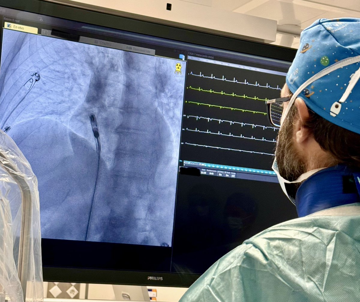 🔝 Som pioners en l'implant de nous marcapassos: la Unitat d’Arrítmies ha col·locat el primer marcapàs sense cables auricular a Espanya

🆕 És un avenç tecnològic significatiu i permet que més pacients es puguin beneficiar de la tecnologia sense cables

ℹ️ i.mtr.cool/jekykgmdse