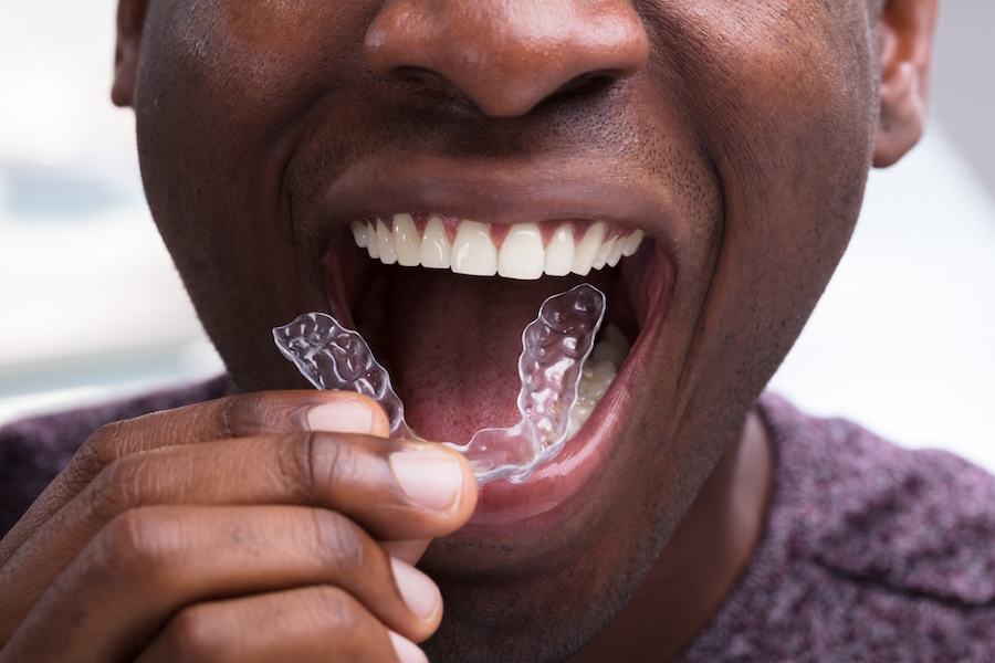 MyGrowingSmile's tweet photo. How To Maintain Your Invisalign Aligners For Optimal Results https://t.co/zgZFZpA7dr https://t.co/G8hwaZ00Ug