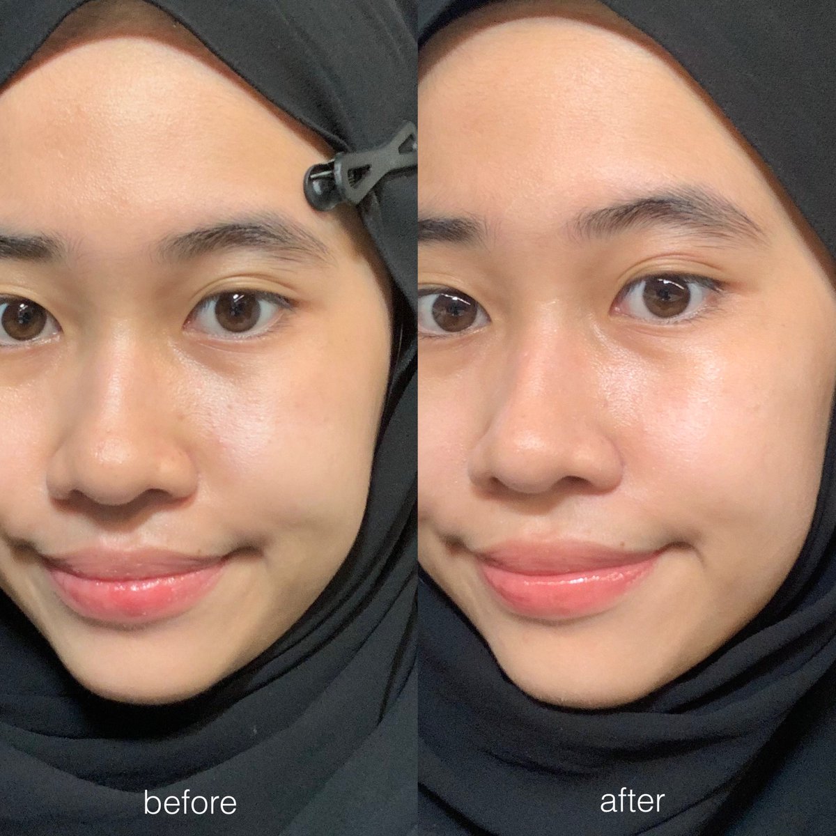 sundaaaey's tweet photo. aku pake C-Star dari brand STARINC, di aku efeknya bisa mudarin bekas jerawat yg baru aja muncul & bikin warna kulit lebih merata #MyCSTAR
🔗 https://t.co/E84eQ6hlGX
ingredientsnya itu ada 26% vit C untuk cerahin + Kakadu Plum Extract juga yg bisa ngilangin garis halus di wajah https://t.co/HXFzQ3KIA7
