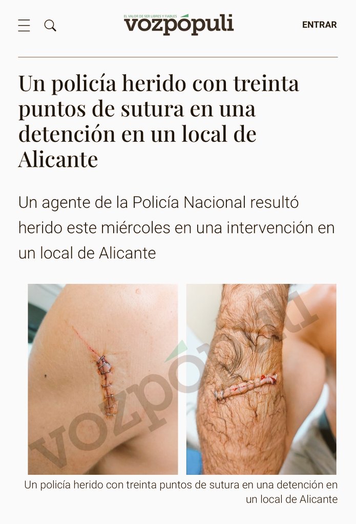 jusapol (@jusapol) on Twitter photo 🔴 Un <a href="/policia/">Policía Nacional</a> herido en la detención de un individuo que se resistió.
TREINTA PUNTOS DE SUTURA‼️
❌ Para Gobierno si los agredidos son policías nacionales o guardias civiles no son #ProfesionDeRiesgoYa, si son policías locales o autonómicos SÍ.
#EquiparacionYa24Sep 🔴 Un <a href="/policia/">Policía Nacional</a> herido en la detención de un individuo que se resistió.
TREINTA PUNTOS DE SUTURA‼️
❌ Para Gobierno si los agredidos son policías nacionales o guardias civiles no son #ProfesionDeRiesgoYa, si son policías locales o autonómicos SÍ.
#EquiparacionYa24Sep