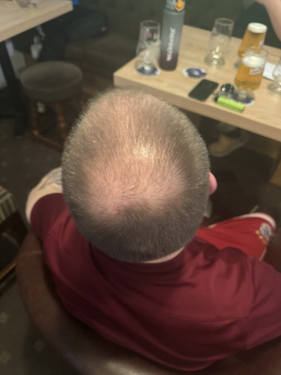 Stag du day! Late flight tonight as a mong books shit flights and accommodation. We will meet up with the other lads already there. Badly booked by baldy. Who’s cheats and who doesn’t that’s the big question? #peake is wank