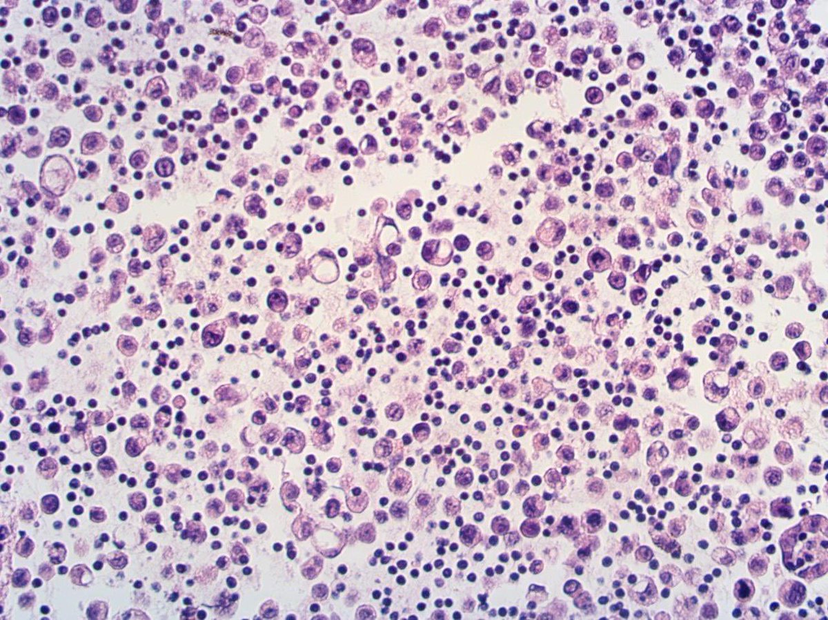 Tim Bracey tweet media