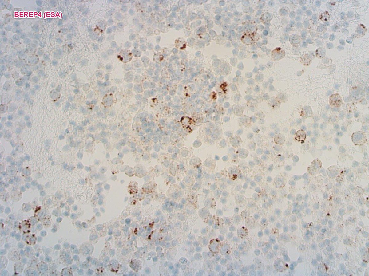 Tim Bracey tweet media