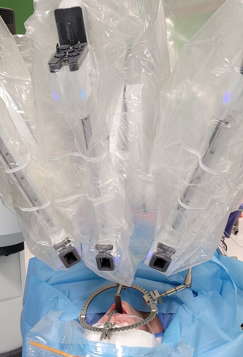The Mediflex® proprietary Mini-Bookler® System for TransOral Robotic Surgery (TORS) is a table mounted, low-profile stabilization platform designed to enable optimal exposure, accommodate all pt sizes &amp; be adaptable for other ENT cases, incl non-robotic. 
#TORS  #AAOHNSF  #ENT