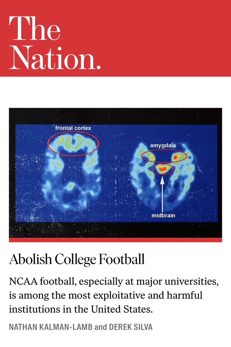 Nathan Kalman-Lamb (@nkalamb) on Twitter photo College football is among the most exploitative and harmful institutions in the US. Coaches, AD officials, presidents and members of the sports media complex richly benefit as players bear the life-altering costs.
Our solution? Abolish it. For <a href="/thenation/">The Nation</a>
thenation.com/?post_type=art… College football is among the most exploitative and harmful institutions in the US. Coaches, AD officials, presidents and members of the sports media complex richly benefit as players bear the life-altering costs.
Our solution? Abolish it. For <a href="/thenation/">The Nation</a>
thenation.com/?post_type=art…