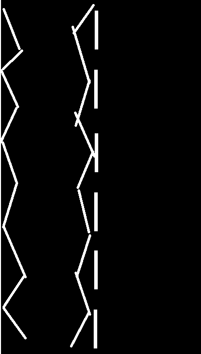 Dear British friends.

What the heck is this that I keep seeing in videos of british roads?

Why do you have saws painted on some of your roads?